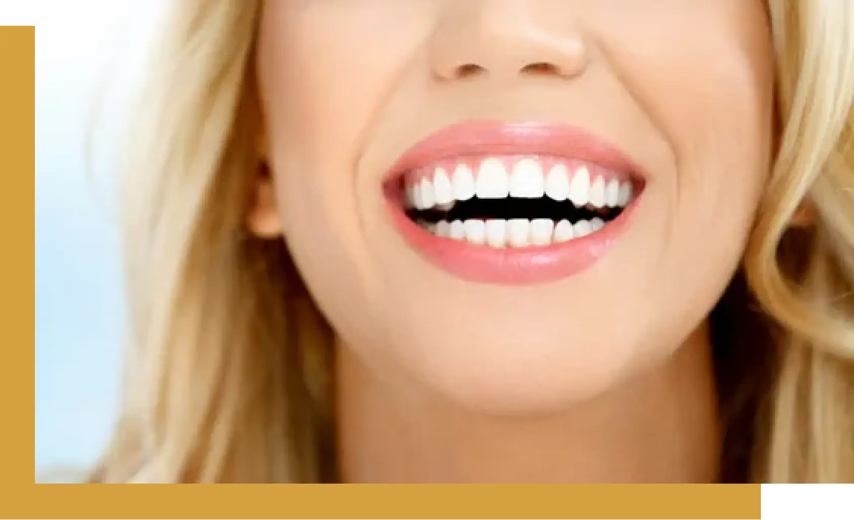 bright smile