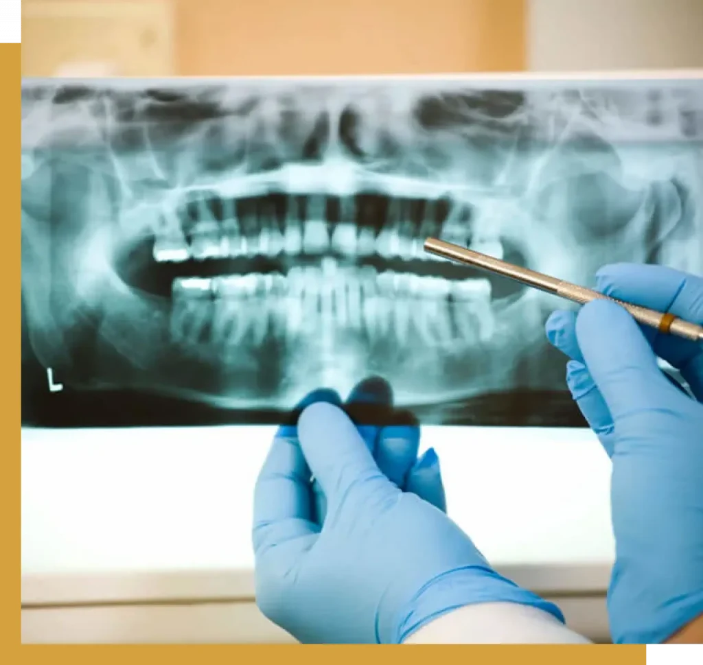 X-ray examination