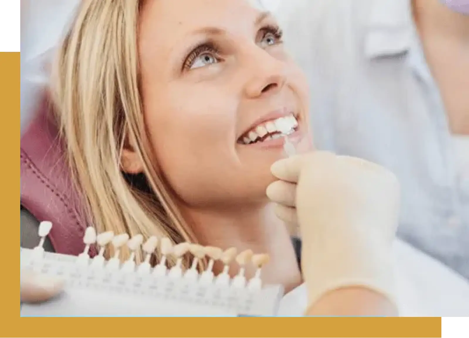 PORCELAIN VENEERS