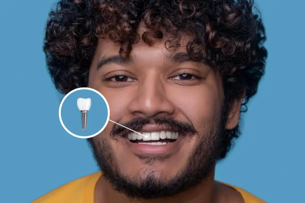 young guy with dental implants