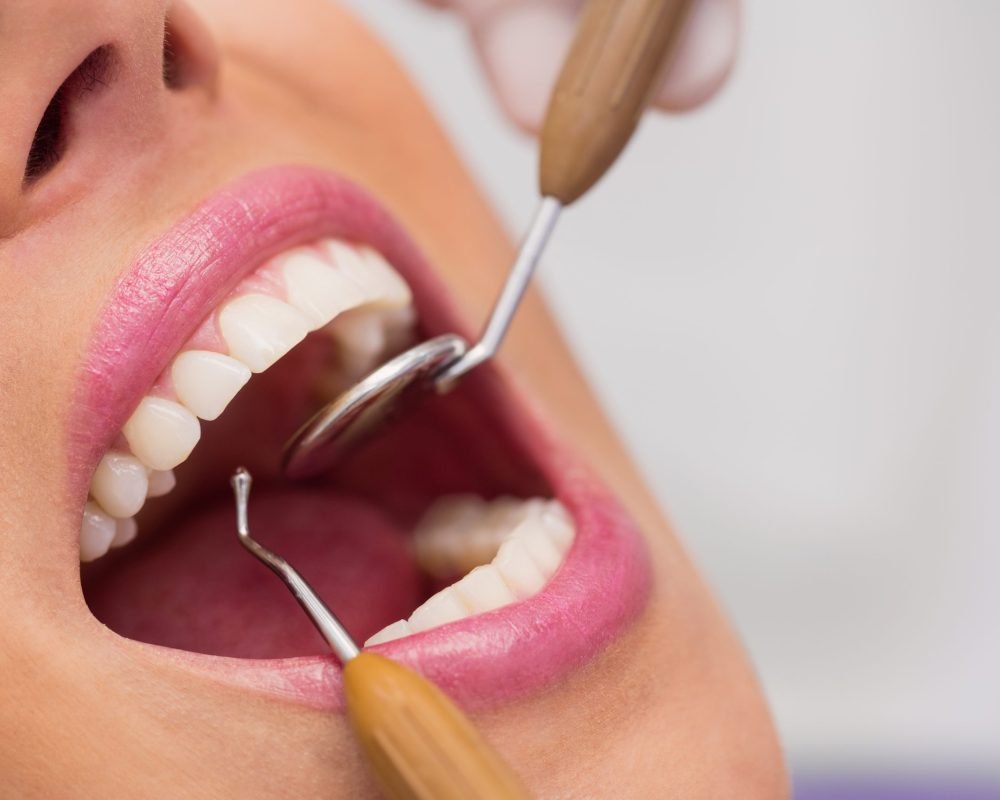 Close up of dentist examining female patient teeth Close up of dentist examining female patient teeth