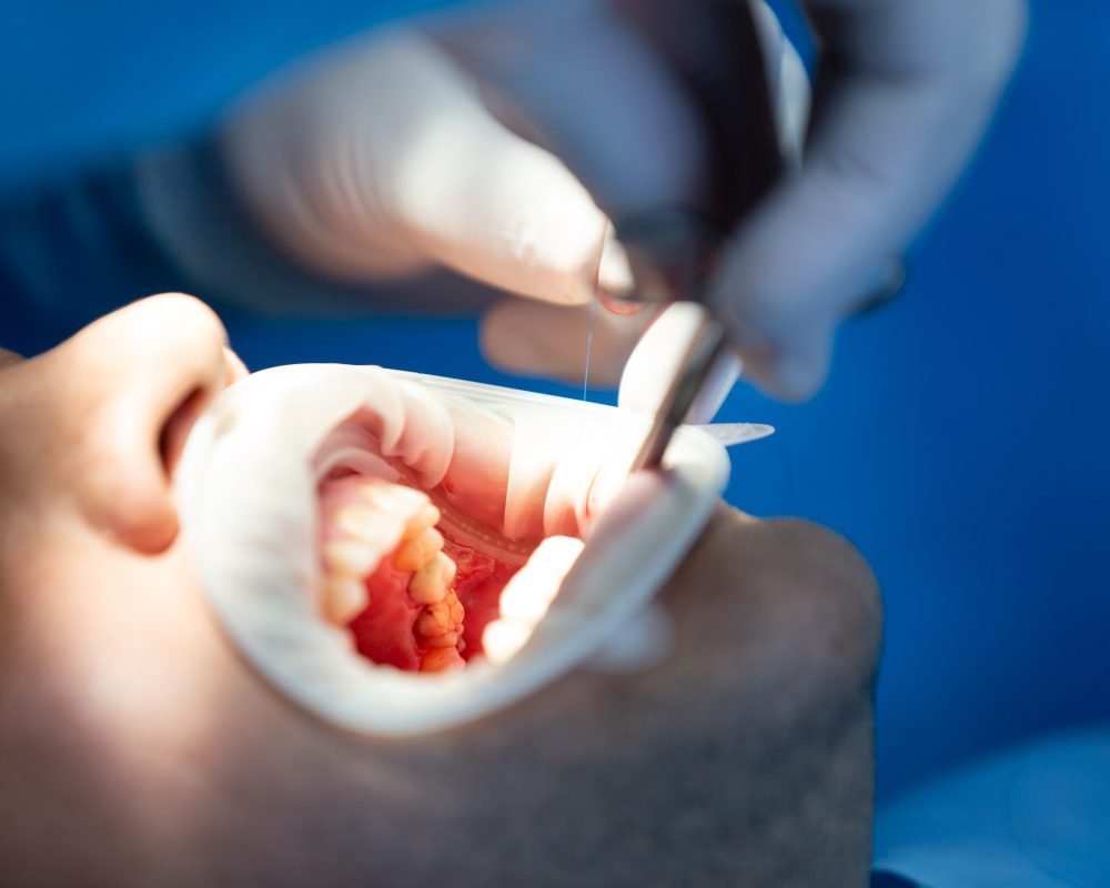 pacient in dental clinic while operation pacient in dental clinic while operation